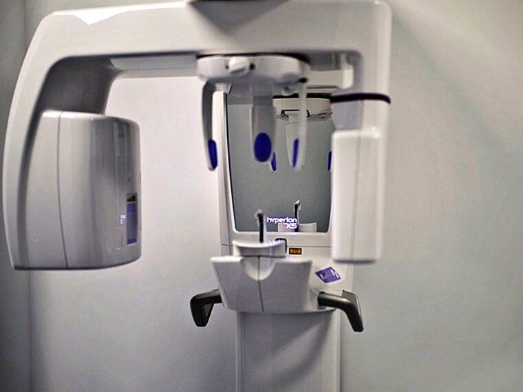 Tomograf stomatologiczny MyRay Hyperion X5 3D w pracowni RTG gabinetu